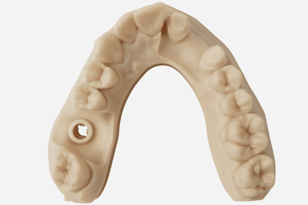 msla 3d printed dental model