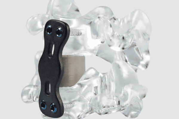 3D Printing Material Guide: PEEK